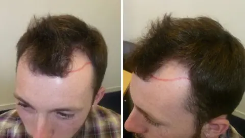 An image of Ian, taken from above. He has red marker pen on his forehead, highlighting where he is balding.
