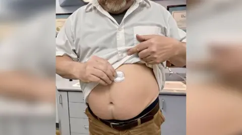 Facebook A screen grab from one of the videos which shows a middle aged man lifting a white shirt to reveal a large stomach, whereupon he places a small white patch. The man appears to be in a clinical doctors setting 