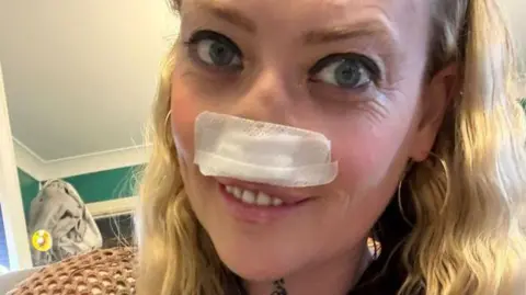 Leanne Abeyance Leanne Abeyance has long blonde hair. She has a large bandage over her nose, and is looking at the camera and smiling.