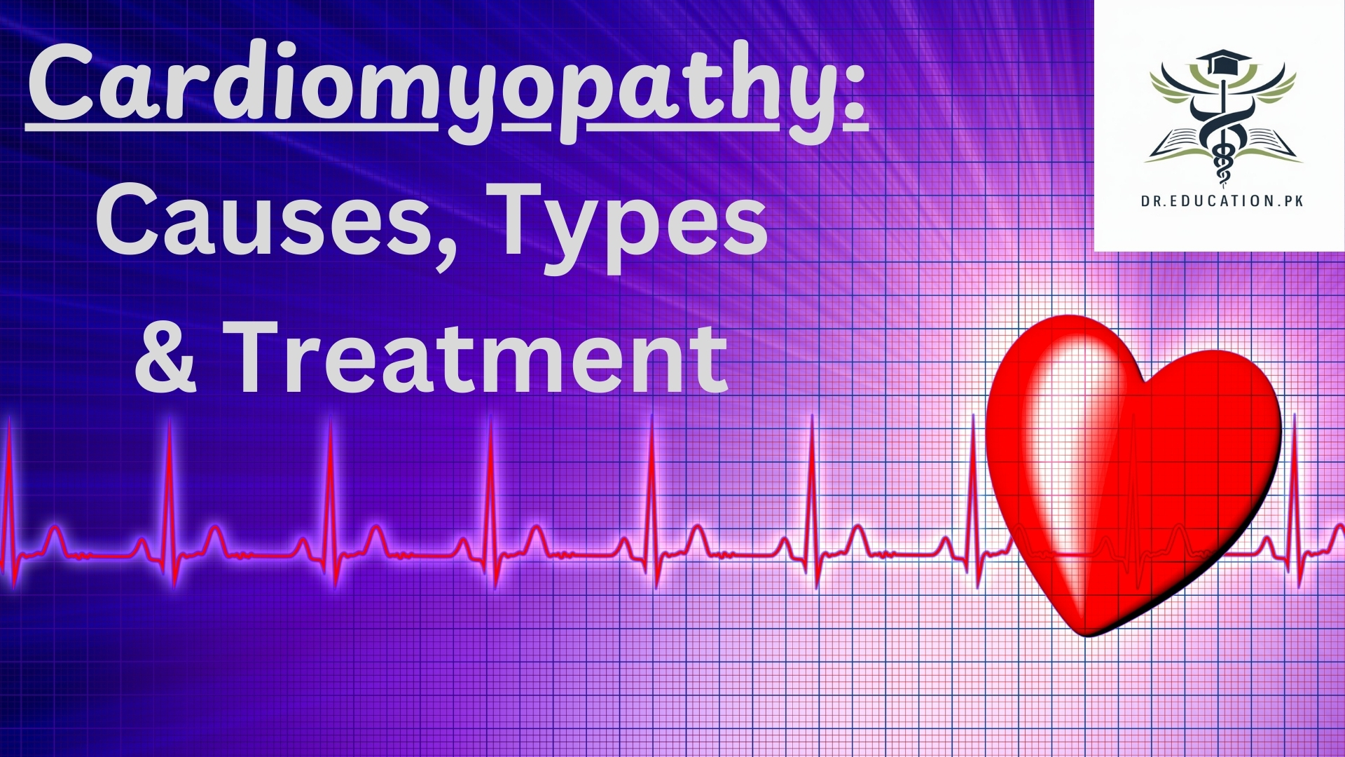 Cardiomyopathy