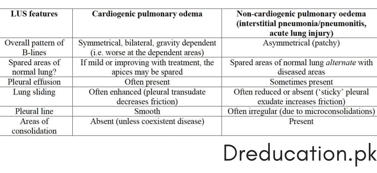 Pulmonary Edema