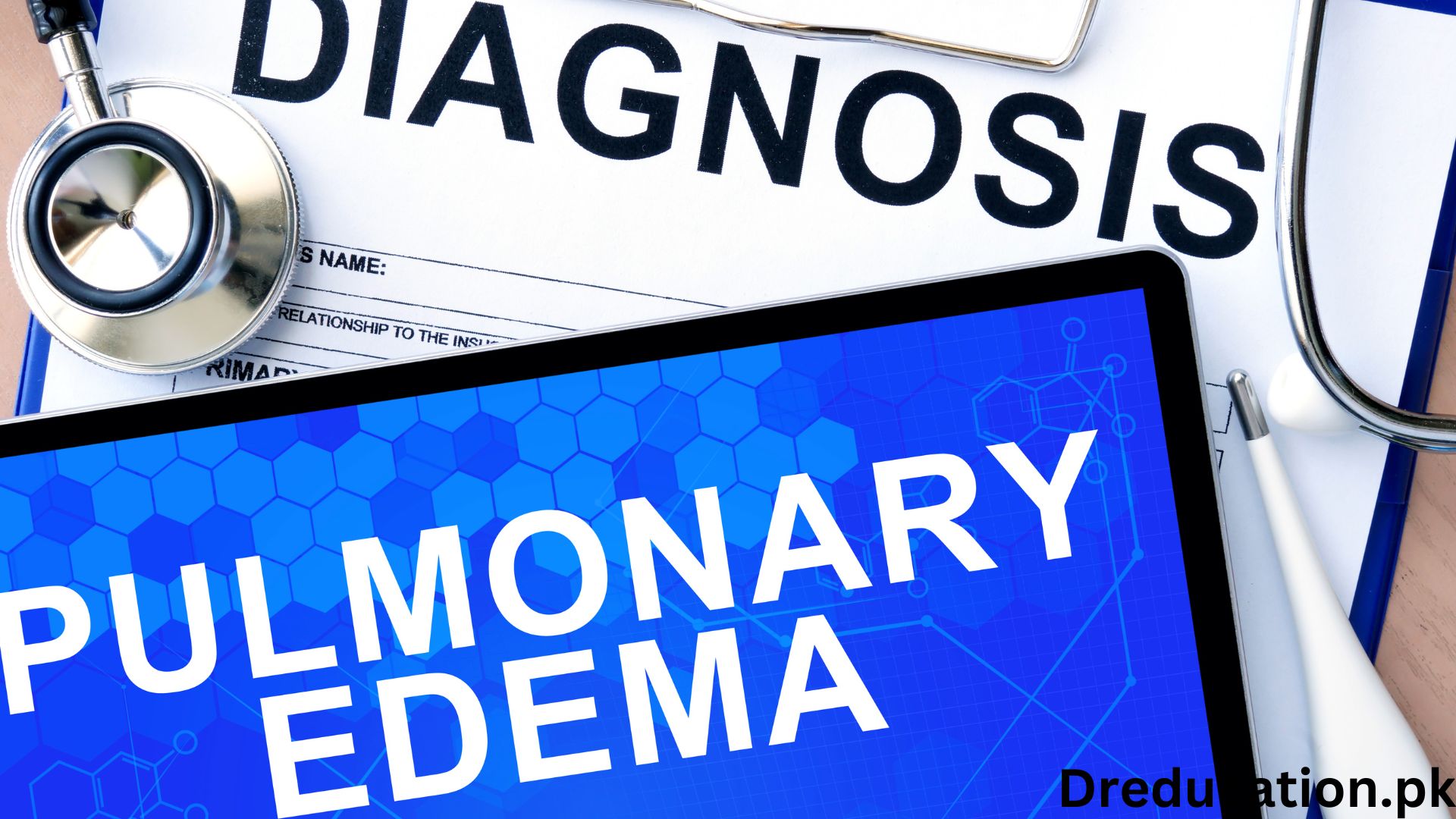 Pulmonary Edema
