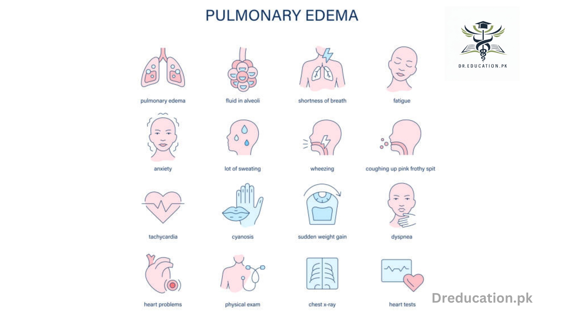 Pulmonary Edema