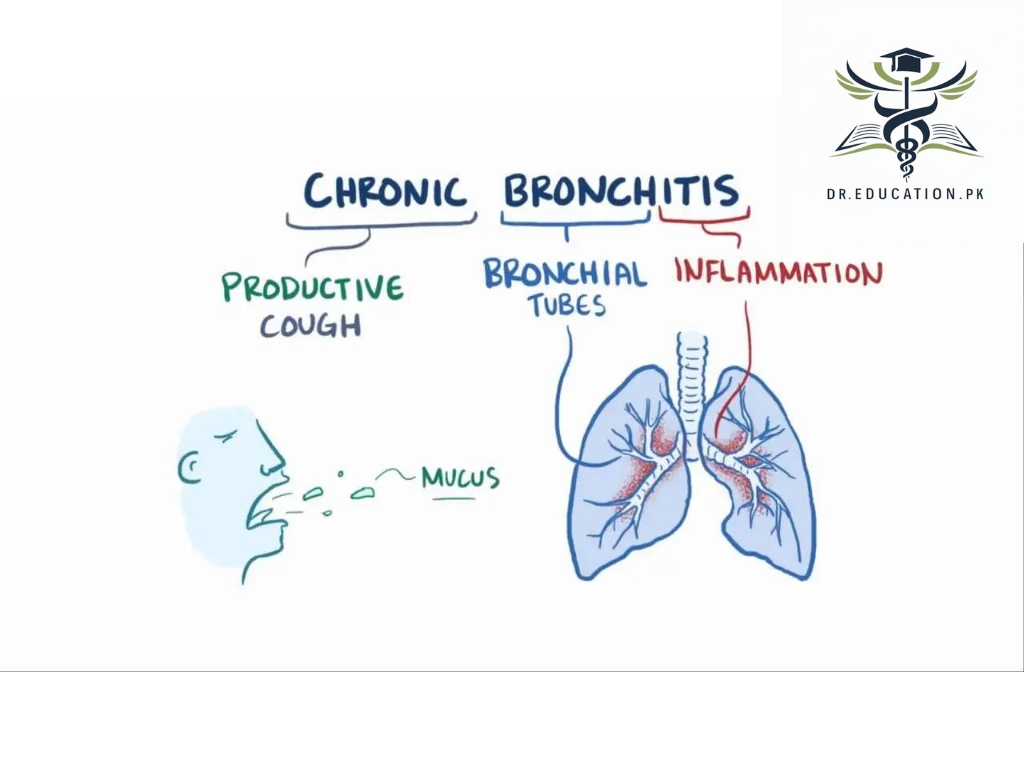 Chronic Bronchitis