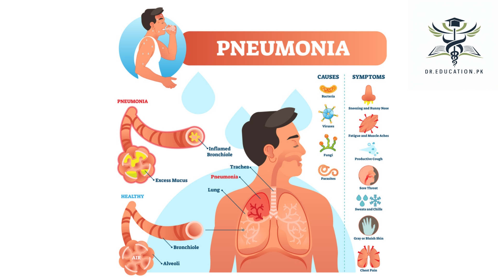 pneumonia