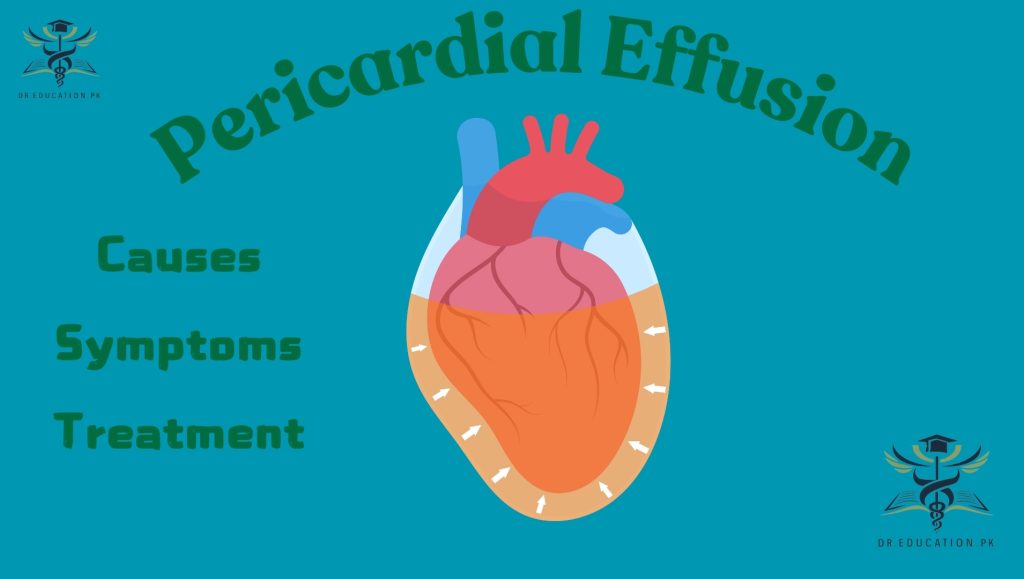 Pericardial Effusion