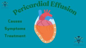 Pericardial Effusion