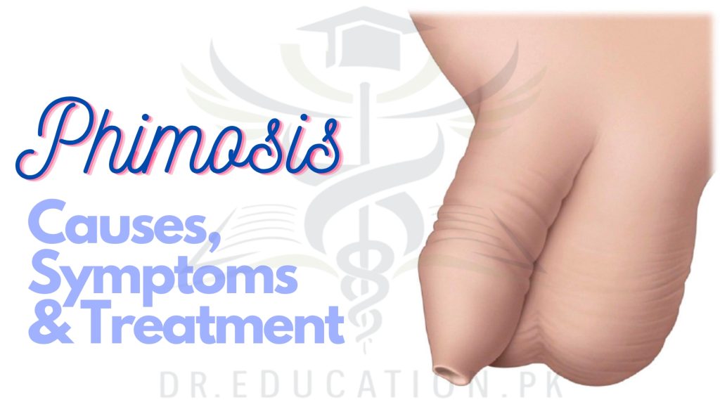 Phimosis