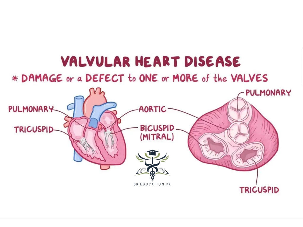valvular heart disease