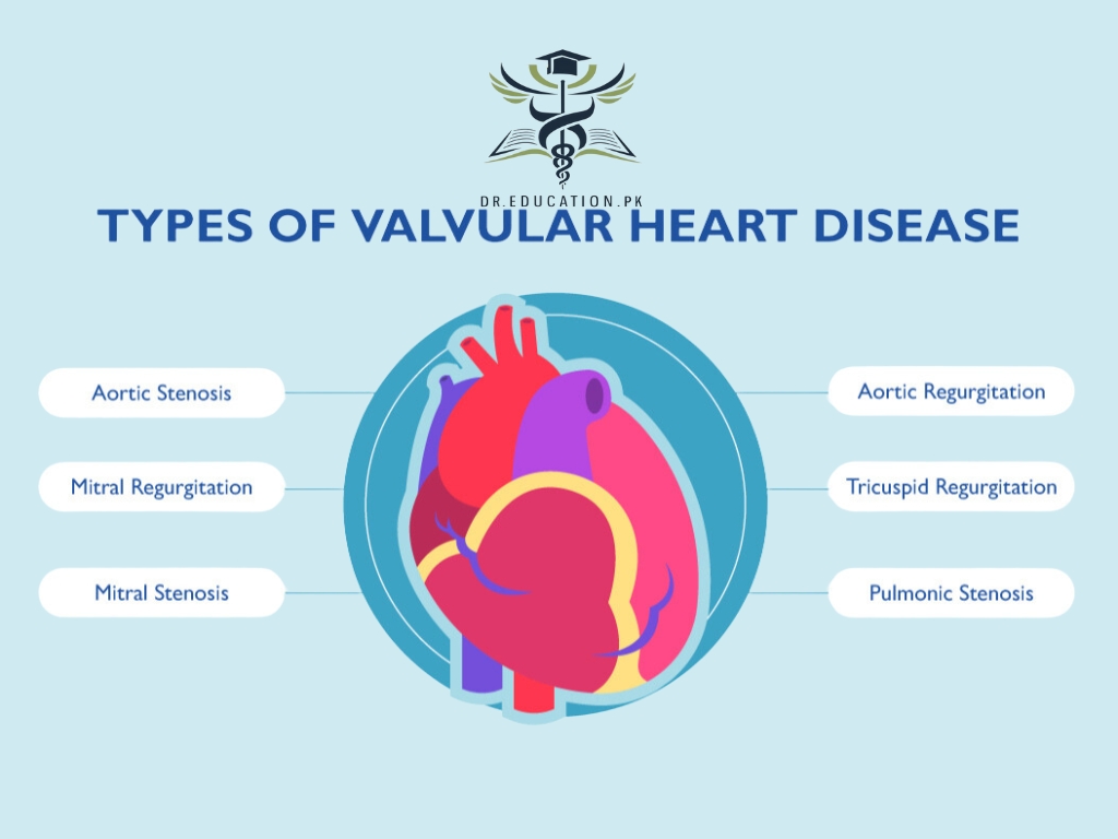 valvular heart disease