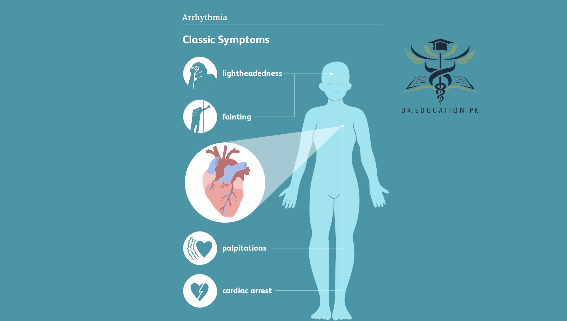 Arrhythmia