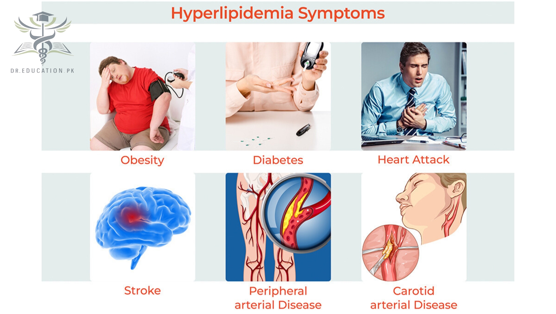 Hyperlipidemia