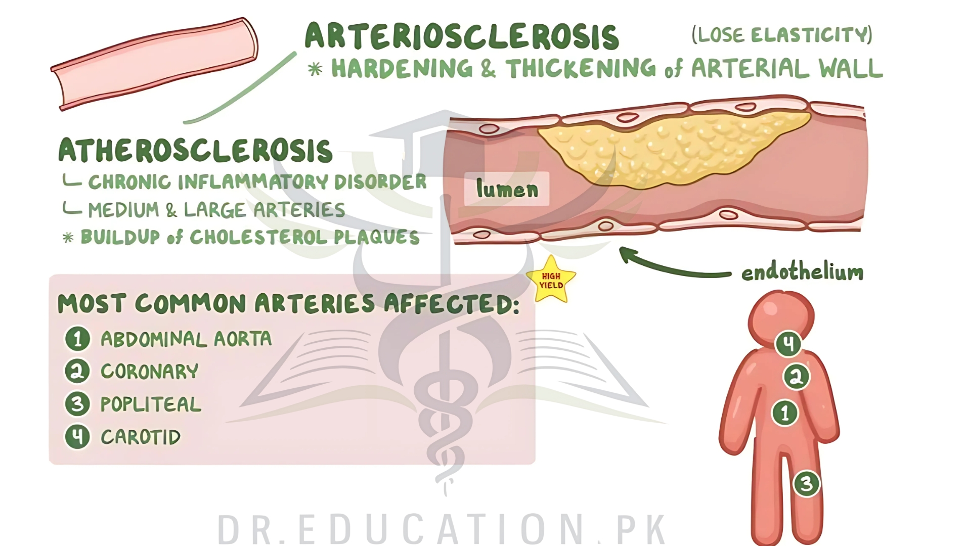 atherosclerosis