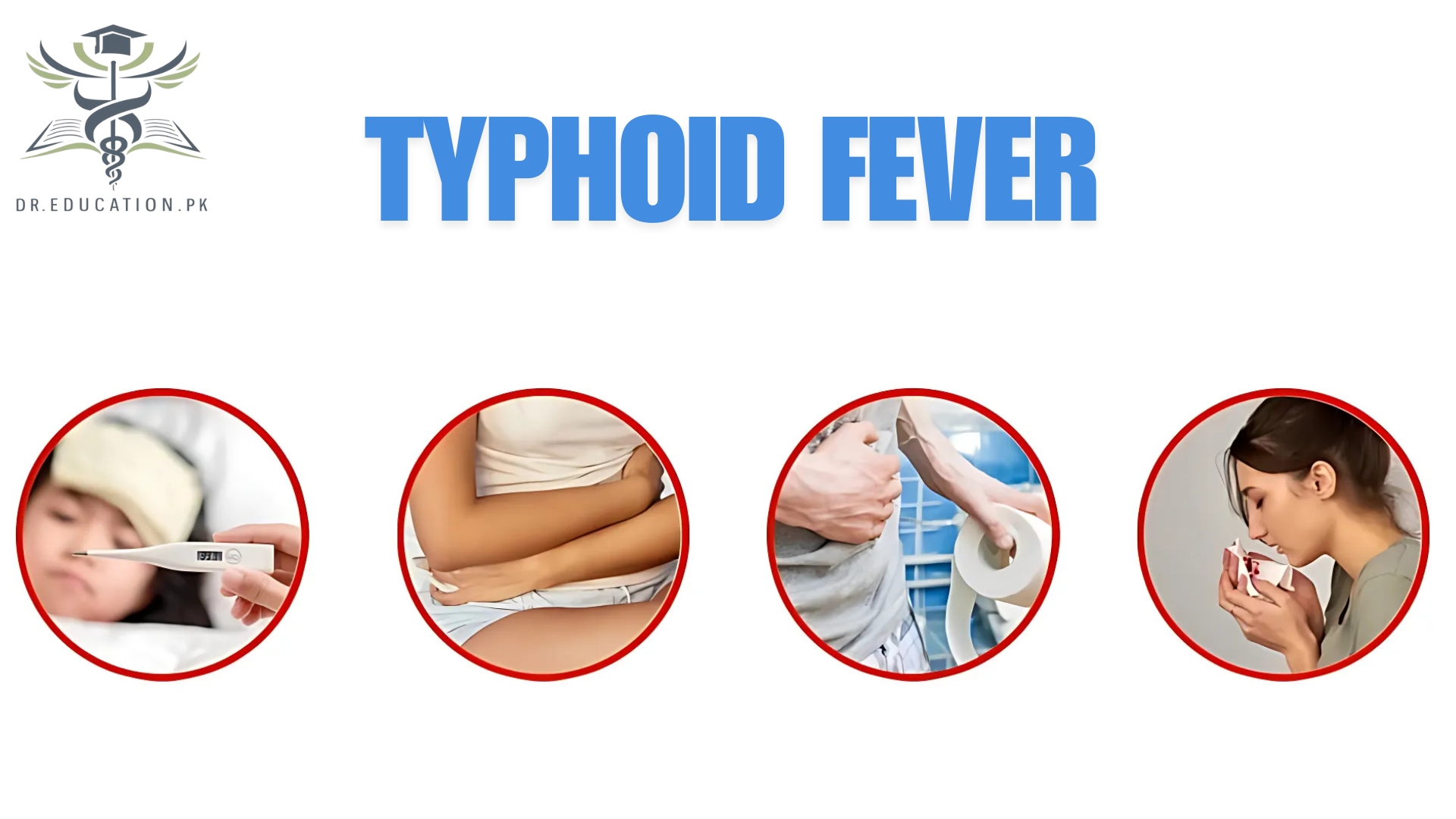 Typhoid Fever