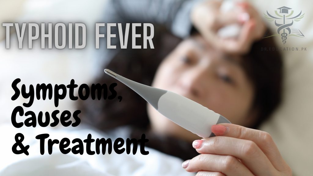 Typhoid Fever