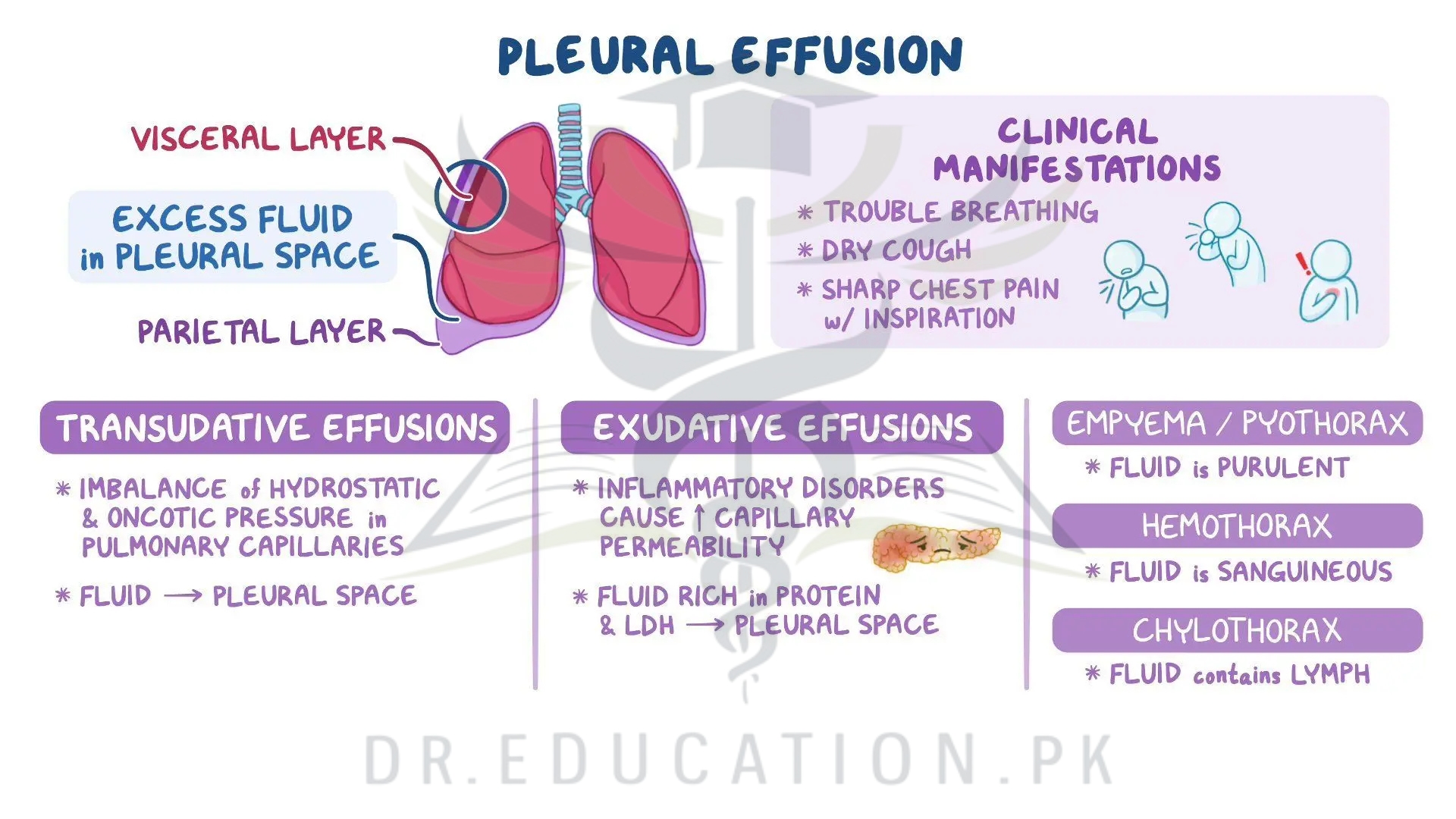 Pleural Effusion