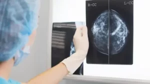Early cancer detection