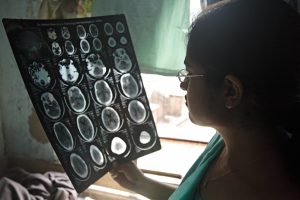 doctor-reviewing-a-brain-scan.tmb-1200v.jpg